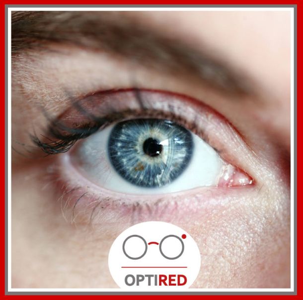 Cuidado de las lentes de contacto